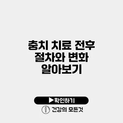 충치 치료 전후 절차와 변화 알아보기